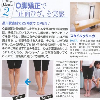 O脚矯正 整体 骨盤矯正 スタイルクリニカ 産後骨盤矯正 品川